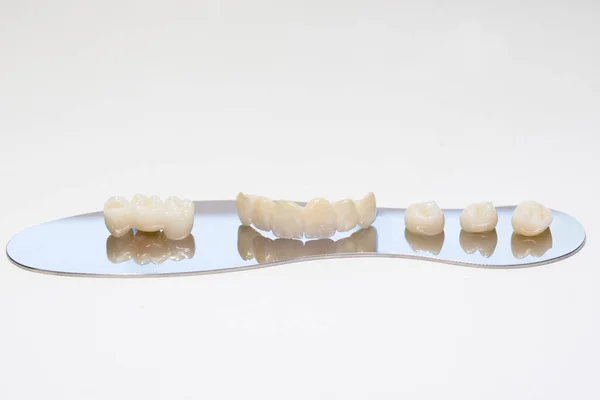 Zirconium tooth crown. Isolate on background. Aesthetic restoration of tooth loss. Ceramic zirconium in final version. Metal Free Ceramic Dental Crowns. — Stock Photo, Image