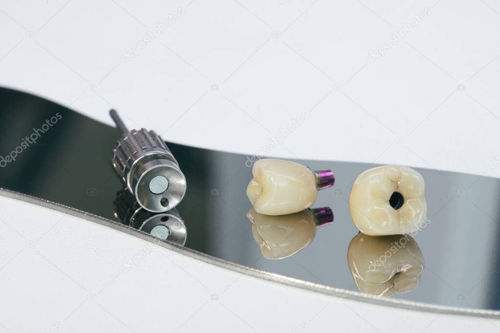 Zirconium crown and zirconium hybrid abutment. Monolithic screw retained zirconium crown on the implant, a screw and a manual key for screwing the crown.