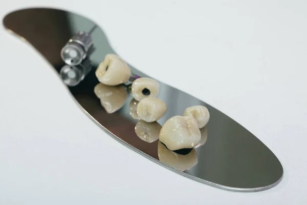 Coroa dental de zircônio dente de mastigação artificial com chave de fenda ortopédica. coroa de zircônio e zircônio pilar híbrido. — Fotografia de Stock