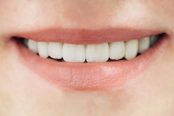 Vackra kvinnliga tänder makro zirkonium. Närbild leende foto med zirkonium konstgjorda tänder. Zirconia bro med porslin. — Stockfoto