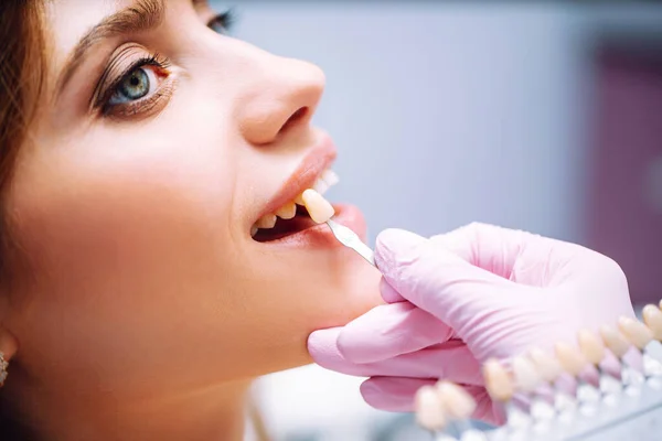Piękna Kobieta Uśmiecha Się Zdrowym Wybielaniem Zębów Dopasowanie Odcieni Implantów — Zdjęcie stockowe