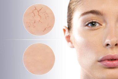 Mükemmel cilt ile güzel bir kadının yüzü ve iki makro zoom cilt kremi (kuru ve kuru) kullanmadan önce ve sonra krem (yumuşak ve nemli) kullanarak kapatın. Kavramı: Cilt Bakımı