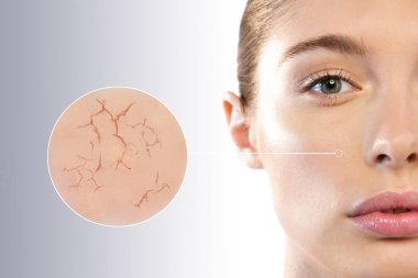 Mükemmel cilt ile güzel bir kadının yüzü ve iki makro zoom cilt kremi (kuru ve kuru) kullanmadan önce ve sonra krem (yumuşak ve nemli) kullanarak kapatın. Kavramı: Cilt Bakımı