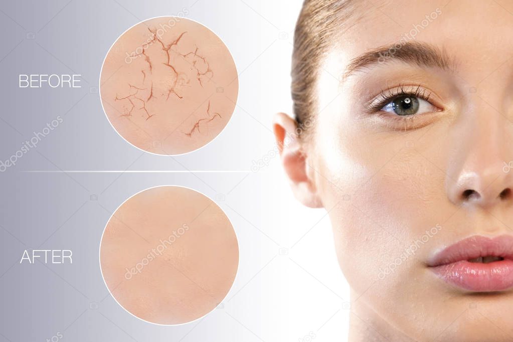 Close up of the face of a beautiful woman with perfect skin and two macro zoom of the skin before using the cream (dry and dry) and after using the cream (soft and moisturized). Concept of:skincare
