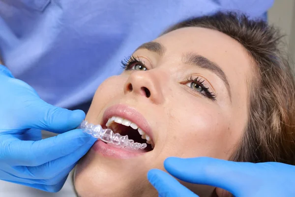 Dalam Praktik Profesional Seorang Dokter Gigi Menempatkan Peralatan Gigi Transparan — Stok Foto
