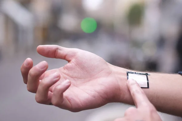 デジタル インプラントや将来の皮膚の下にマイクロ チップを人間の腕 生体インプラントと未来技術 — ストック写真
