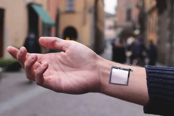 Lengan Manusia Dengan Implan Digital Dan Microchip Bawah Kulit Masa — Stok Foto