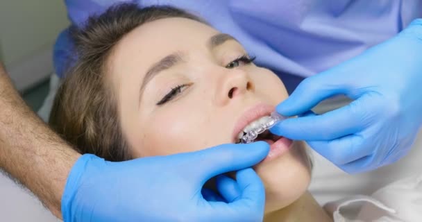 Wideo Lekarzem Zdejmowaniu Wyjmowane Tacę Invisalign Zębów Kobiety — Wideo stockowe