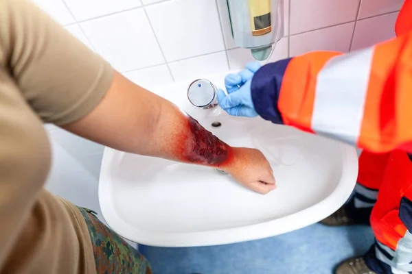 Sanitäter Kühlt Eine Brandwunde — Stockfoto