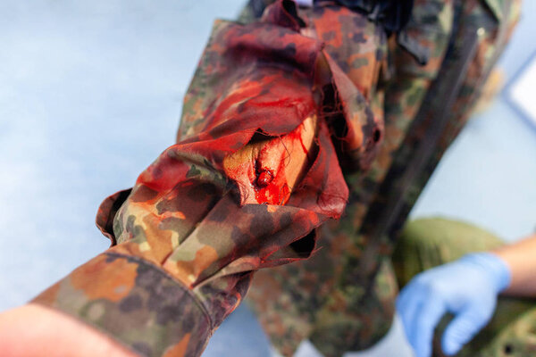 Парамедик лечит перелом.
