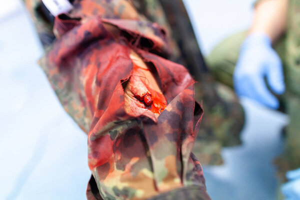 Парамедик лечит перелом.
