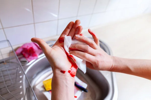 Woman Cuts Herself Knife Kitchen — Stock Photo, Image