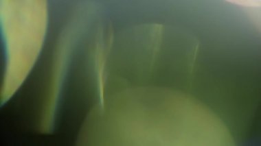 Stüdyoda Siyah Arkaplan Üzerine Gerçek Lens Fişeği Çekimi