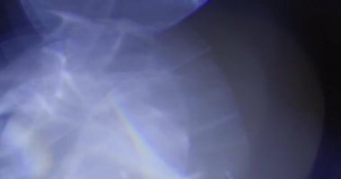 Stüdyoda Siyah Arkaplan Üzerine Gerçek Lens Fişeği Çekimi