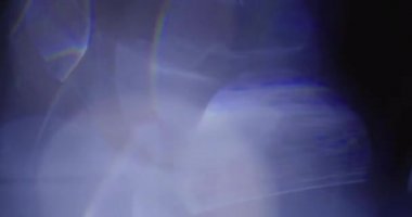 Stüdyoda Siyah Arkaplan Üzerine Gerçek Lens Fişeği Çekimi