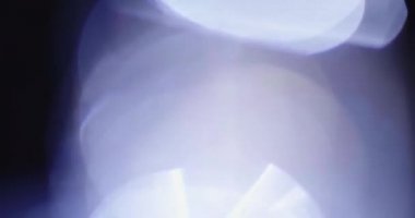 Stüdyoda Siyah Arkaplan Üzerine Gerçek Lens Fişeği Çekimi