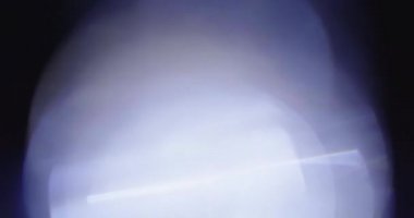 Stüdyoda Siyah Arkaplan Üzerine Gerçek Lens Fişeği Çekimi