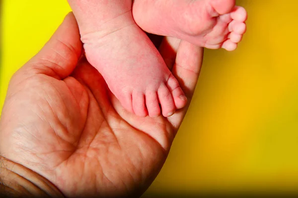 Babybeine Auf Gelbem Hintergrund Papa Hält Die Kleinen Beine Eines — Stockfoto