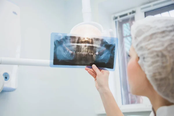 Profesjonalny stomatolog sprawdzający zdjęcie rentgenowskie zębów — Zdjęcie stockowe