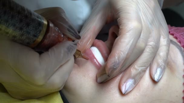 Kosmetolog Orsakar Färg Nålen Konturen Läpparna För Kvinna Som Ligger — Stockvideo
