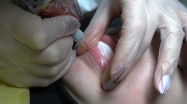 Kalıcı Dudak Makyajı yordam aşırı yakın çekim. Şevval özçelik güzellik güzellik salonu bir genç kızın alt dudak üzerinde iğneyle boya hıyarlar. Portre. Üstten görünüm. 4 k. 25 fps