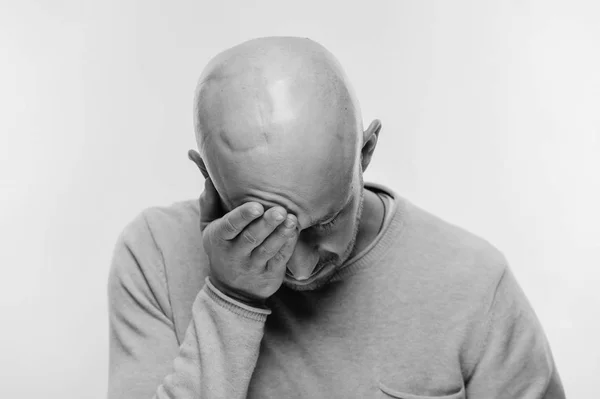 black and white photo of bald man with psychological stress struggling for life after cancer neurosurgery operation