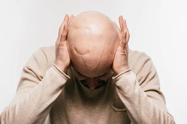 Homem Careca Com Estresse Psicológico Lutando Pela Vida Após Cirurgia — Fotografia de Stock