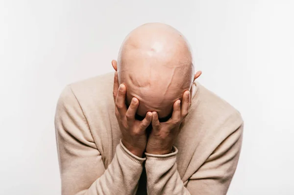 Bald man with psychological stress struggling for life after cancer neurosurgery operation