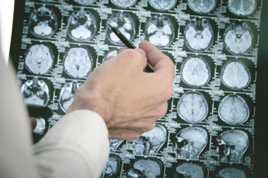 Doktor x-ışını bilgisayarlı tomografi denetliyor