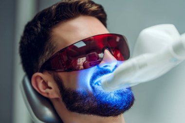 Diş beyazlatma. Diş Uv lazer beyazlatma cihazı ile dişleri beyazlatıldı sahip adam. Diş beyazlatma makinesi, gözlükile korunan gözler.