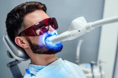 Lekeleri ve renk değişikliği kaldırmak için lazer diş beyazlatma tedavisi gören adamın yakından görünümü.