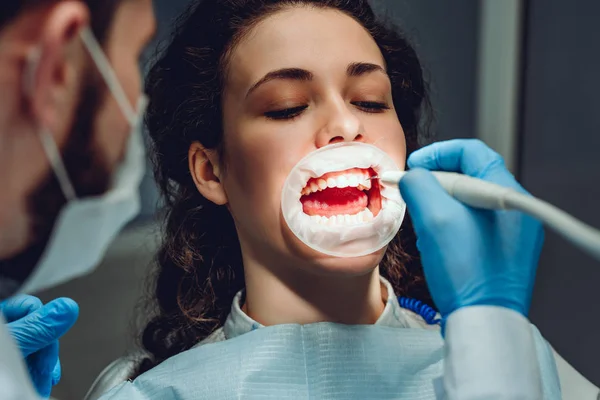 Пацієнт у стоматолога. Лікування зубів спеціальним обладнанням. Крупний план перегляду . — стокове фото