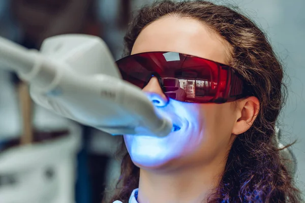 A jovem branqueia os dentes no dentista. Vista de perto . — Fotografia de Stock