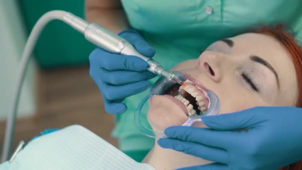 Glazuur met calcium gebaseerde plakken na de ultrasone reiniging van de tanden polijsten. — Stockvideo