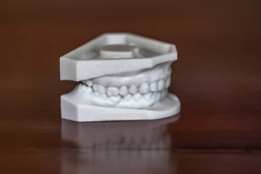 Diş analizi ile çalışma modeli, 3 boyutlu baskı ile elde edilen reçine modeli, diş implantları için