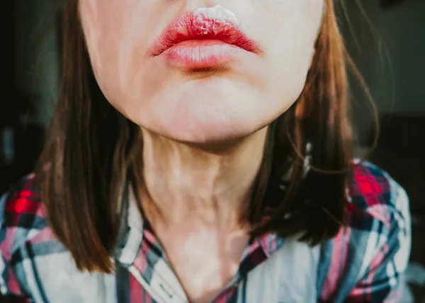 close-up view of the lips of a young girl with herpes