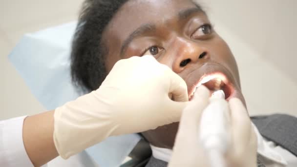 El dentista examina con macro cámara la cavidad oral del paciente. Joven paciente afroamericano en silla en la clínica dental. Medicina, salud, concepto de estomatología . — Vídeos de Stock