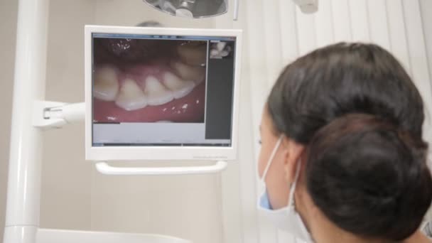 El dentista examina con macro cámara la cavidad oral del paciente. Joven paciente afroamericano en silla en la clínica dental. Medicina, salud, concepto de estomatología . — Vídeos de Stock