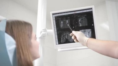 Doktor röntgen bir resmi ekranda gösteriyor. Diş Kliniği, dişçi sandalyede güzel bir genç kız portresi. Tıp, sağlık, stomatology kavramı. bir hastayı tedavi diş hekimi.