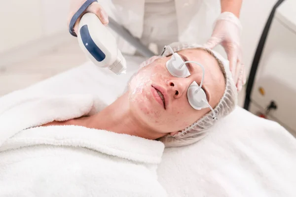 O médico aplica um gel especial ao paciente. Fototerapia anti acne com equipamento profissional. Mulher bonita durante o procedimento de rejuvenescimento da foto. Tratamento da pele da cara na clínica cosmética . — Fotografia de Stock