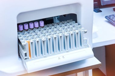  Tıbbi otomatik idrar ve kan analiz cihazı.