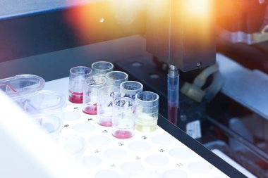 Tıbbi otomatik idrar ve kan analiz cihazı. 