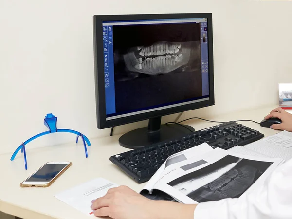 Лікар Стоматолог Працює Комп Ютером Рентгенівське Зображення Щелепи Зубів Людини — стокове фото