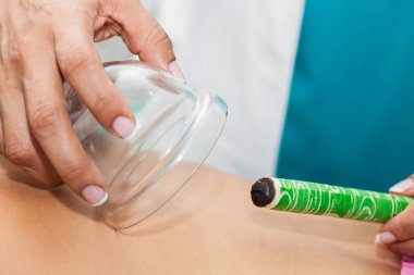 Doktor moxibustion terapi genç bayan hasta üzerinde performans geri