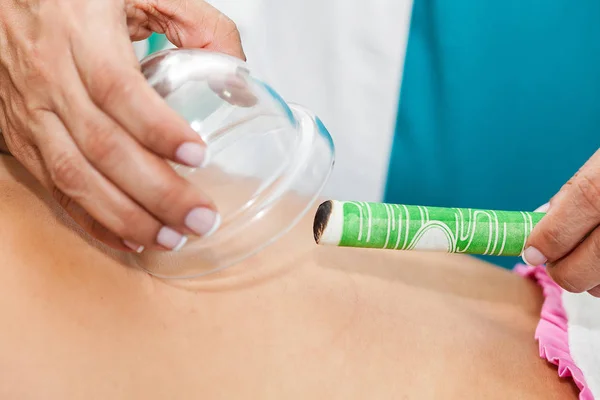 Médico realizando uma terapia de moxabustão em uma jovem paciente do sexo feminino — Fotografia de Stock