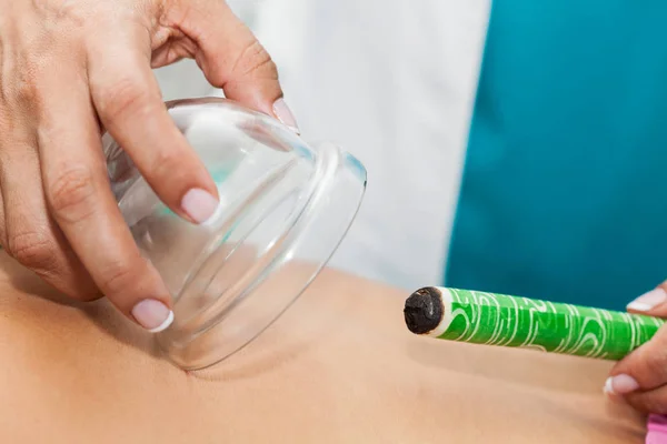 Läkare utför en moxibustion terapi på en ung kvinnlig patient tillbaka — Stockfoto