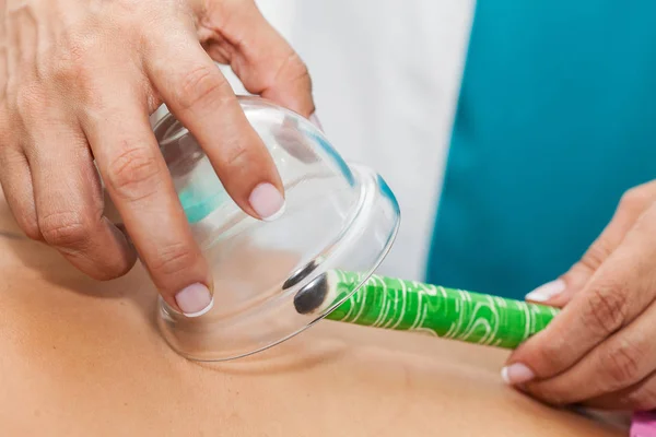 Läkare utför en moxibustion terapi på en ung kvinnlig patient tillbaka — Stockfoto
