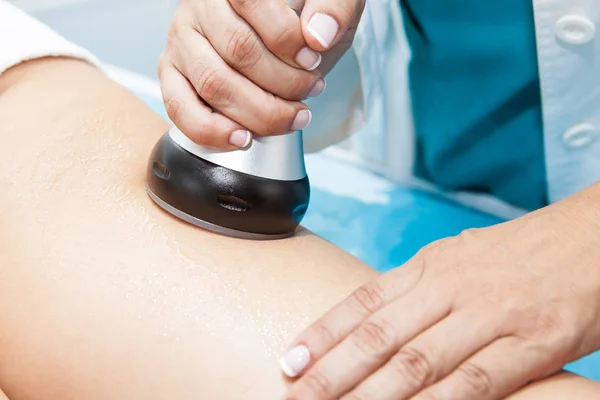 Médico realizando un tratamiento de ultracavitación en una pierna de paciente joven — Foto de Stock