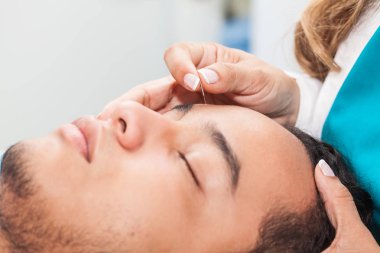 Genç bir erkek hasta üzerinde performans gösteren yüz akupunktur doktor