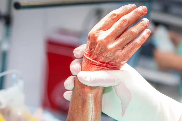 Doctor disinfecting the hand of a patient prior to a hand surger